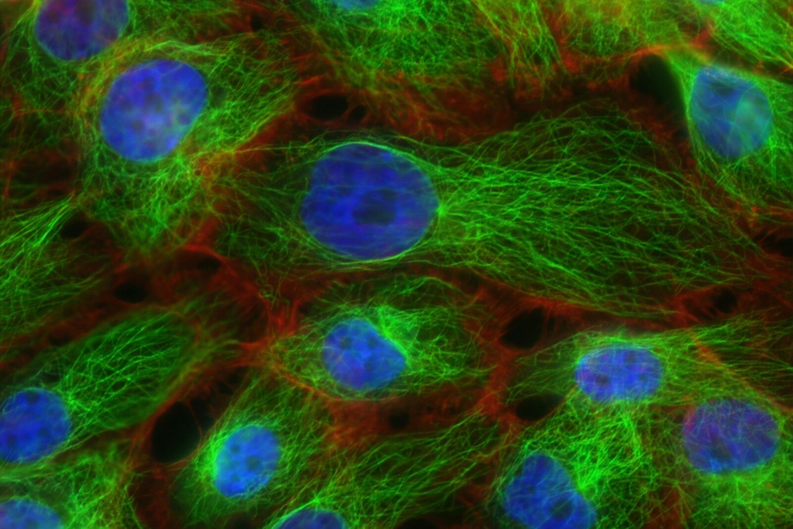 cancer cells